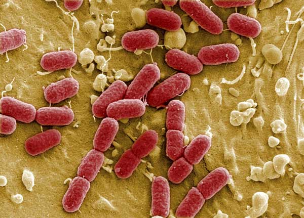 Oorzaak EHEC bacterie volgens Ongeordend